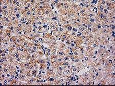 SERPINB4 / SCCA1+2 Antibody - IHC of paraffin-embedded Human liver tissue using anti-SERPINB4 mouse monoclonal antibody.