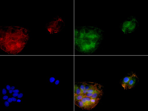 SERPINB4 / SCCA1+2 Antibody - Immunofluorescent staining of HepG2 cells using SERPINB4 mouse monoclonal antibody  green). Actin filaments were labeled with TRITC-phalloidin. (red), and nuclear with DAPI. (blue). The three-color overlay image is located at the bottom-right corner.