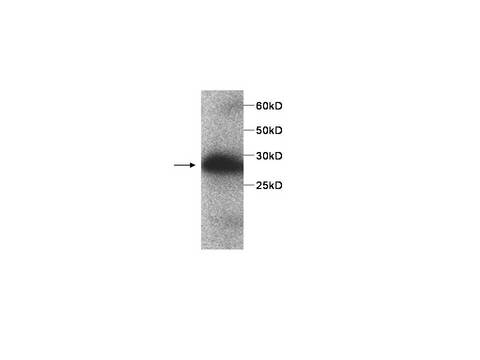 SERPINB4 / SCCA1+2 Antibody