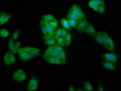 SERPINB4 / SCCA1+2 Antibody - Immunofluorescence staining of HepG2 cells at a dilution of 1:200, counter-stained with DAPI. The cells were fixed in 4% formaldehyde, permeabilized using 0.2% Triton X-100 and blocked in 10% normal Goat Serum. The cells were then incubated with the antibody overnight at 4 °C.The secondary antibody was Alexa Fluor 488-congugated AffiniPure Goat Anti-Rabbit IgG (H+L) .