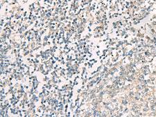 SERPINB4 / SCCA1+2 Antibody - Immunohistochemistry of paraffin-embedded Human tonsil tissue  using SERPINB4 Polyclonal Antibody at dilution of 1:40(×200)