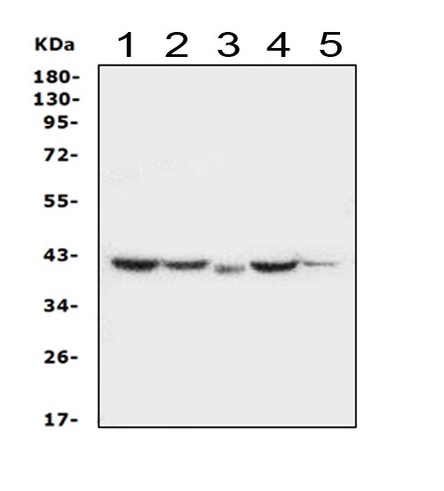 SERPINB5 / Maspin Antibody - Western blot analysis of MASPIN using anti-MASPIN antibody. Electrophoresis was performed on a 5-20% SDS-PAGE gel at 70V (Stacking gel) / 90V (Resolving gel) for 2-3 hours. The sample well of each lane was loaded with 50ug of sample under reducing conditions. Lane 1: rat small intestine tissue lysates, Lane 2: mouse small intestine tissue lysates, Lane 3: human placenta tissue lysates, Lane 4: human MDA-MB-231 whole cell lysates, Lane 5: human MCF-7 whole cell lysates, After Electrophoresis, proteins were transferred to a Nitrocellulose membrane at 150mA for 50-90 minutes. Blocked the membrane with 5% Non-fat Milk/ TBS for 1.5 hour at RT. The membrane was incubated with rabbit anti-MASPIN antigen affinity purified polyclonal antibody at 0.5 µg/mL overnight at 4°C, then washed with TBS-0.1% Tween 3 times with 5 minutes each and probed with a goat anti-rabbit IgG-HRP secondary antibody at a dilution of 1:10000 for 1.5 hour at RT. The signal is developed using an Enhanced Chemiluminescent detection (ECL) kit with Tanon 5200 system. A specific band was detected for MASPIN at approximately 42KD. The expected band size for MASPIN is at 42KD.