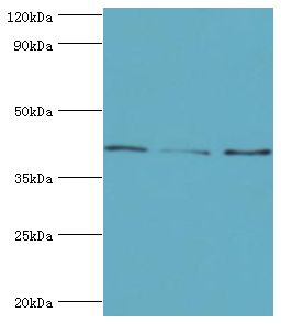 SERPINB5 / Maspin Antibody - Western blot. All lanes: Serpin B5 antibody at 10 ug/ml. Lane 1: HepG2 whole cell lysate. Lane 2: HeLa whole cell lysate. Lane 3: A431 whole cell lysate. secondary Goat polyclonal to rabbit at 1:10000 dilution. Predicted band size: 42 kDa. Observed band size: 42 kDa.
