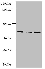 SERPINB5 / Maspin Antibody - Western blot All lanes: Serpin B5 antibody at 10µg/ml Lane 1: HepG2 whole cell lysate Lane 2: Hela whole cell lysate Lane 3: A431 whole cell lysate Secondary Goat polyclonal to rabbit IgG at 1/10000 dilution Predicted band size: 43, 26 kDa Observed band size: 43 kDa