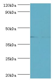 SERPINB5 / Maspin Antibody - Western blot. All lanes: Serpin B5 antibody at 2 ug/ml. Lane 1: HepG2 whole cell lysate. Lane 2: A431 whole cell lysate. Secondary antibody: Goat polyclonal to rabbit at 1:10000 dilution. Predicted band size: 42 kDa. Observed band size: 42 kDa Immunohistochemistry.