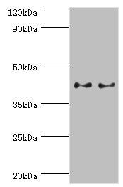 SERPINB5 / Maspin Antibody - Western blot All lanes: Serpin B5 antibody at 2µg/ml Lane 1: HepG2 whole cell lysate Lane 2: A431 whole cell lysate Secondary Goat polyclonal to rabbit IgG at 1/10000 dilution Predicted band size: 43, 26 kDa Observed band size: 43 kDa