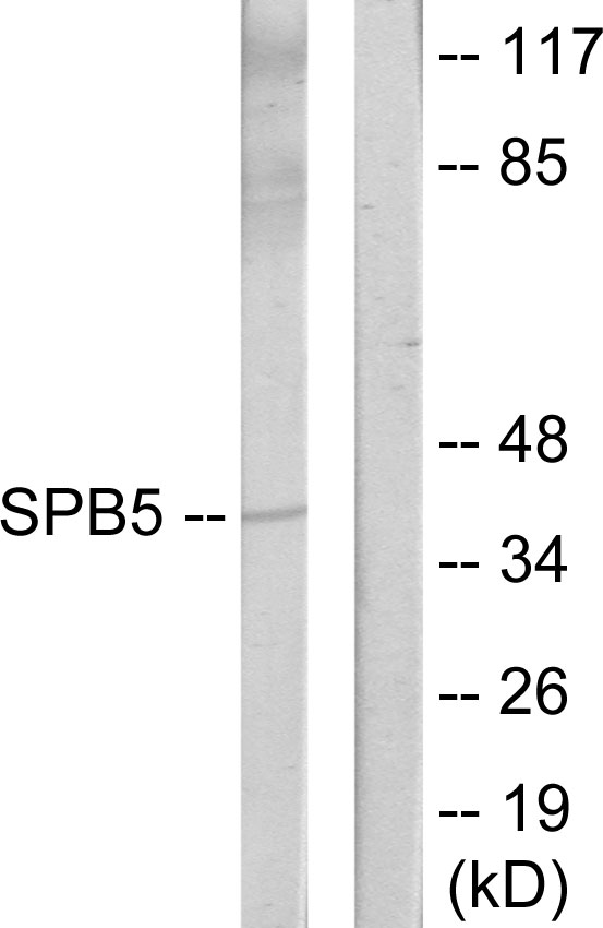 SERPINB5 / Maspin Antibody - Western blot analysis of lysates from HeLa cells, using Serpin B5 Antibody. The lane on the right is blocked with the synthesized peptide.