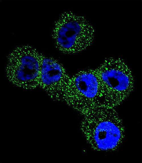 SERPINB5 / Maspin Antibody - Confocal immunofluorescence of Maspin Antibody with A2058 cell followed by Alexa Fluor 488-conjugated goat anti-rabbit lgG (green). DAPI was used to stain the cell nuclear (blue).
