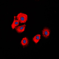 SERPINB5 / Maspin Antibody - Immunofluorescent analysis of Serpin B5 staining in HeLa cells. Formalin-fixed cells were permeabilized with 0.1% Triton X-100 in TBS for 5-10 minutes and blocked with 3% BSA-PBS for 30 minutes at room temperature. Cells were probed with the primary antibody in 3% BSA-PBS and incubated overnight at 4 C in a humidified chamber. Cells were washed with PBST and incubated with a DyLight 594-conjugated secondary antibody (red) in PBS at room temperature in the dark. DAPI was used to stain the cell nuclei (blue).