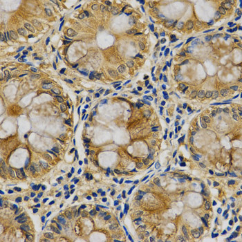 SERPINB5 / Maspin Antibody - Immunohistochemistry of paraffin-embedded human colon using SERPINB5 antibody at dilution of 1:200 (x400 lens)