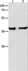 SERPINB5 / Maspin Antibody - Western blot analysis of Mouse esophagus and human cervical cancer tissue, using SERPINB5 Polyclonal Antibody at dilution of 1:1000.