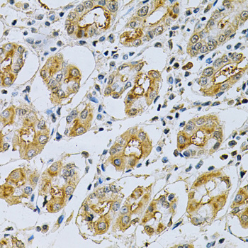 SERPINB5 / Maspin Antibody - Immunohistochemistry of paraffin-embedded human stomach using SERPINB5 Antibody at dilution of 1:200 (40x lens).