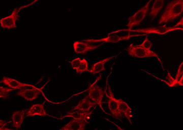 SERPINB5 / Maspin Antibody - Staining HeLa cells by IF/ICC. The samples were fixed with PFA and permeabilized in 0.1% Triton X-100, then blocked in 10% serum for 45 min at 25°C. The primary antibody was diluted at 1:200 and incubated with the sample for 1 hour at 37°C. An Alexa Fluor 594 conjugated goat anti-rabbit IgG (H+L) Ab, diluted at 1/600, was used as the secondary antibody.
