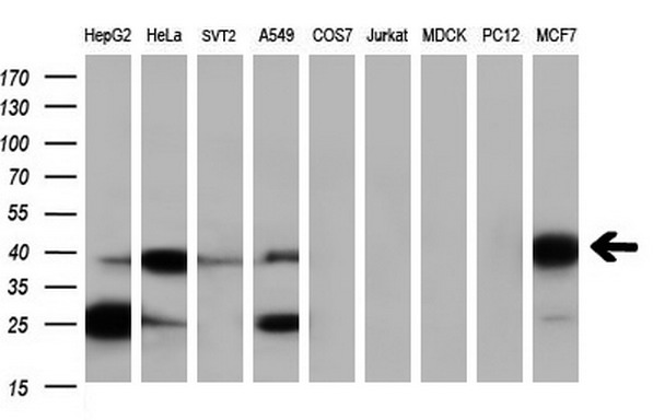 SERPINB6 / PI-6 Antibody - Western blot of extracts (35ug) from 9 different cell lines by using anti-SERPINB6 monoclonal antibody.