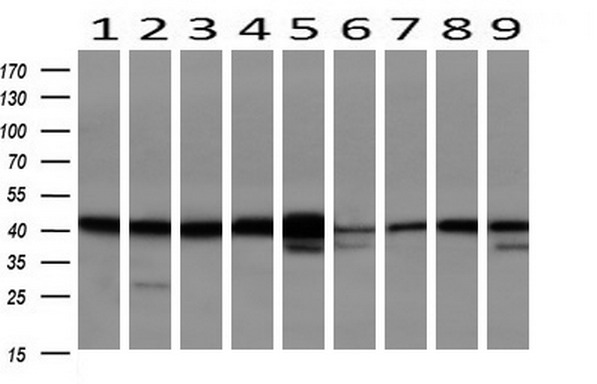 SERPINB6 / PI-6 Antibody - Western blot of extracts (10ug) from 9 Human tissue by using anti-SERPINB6 monoclonal antibody at 1:200 (1: Testis; 2: Omentum; 3: Uterus; 4: Breast; 5: Brain; 6: Liver; 7: Ovary; 8: Thyroid gland; 9: colon).