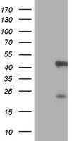 SERPINB6 / PI-6 Antibody - HEK293T cells were transfected with the pCMV6-ENTRY control (Left lane) or pCMV6-ENTRY SERPINB6 (Right lane) cDNA for 48 hrs and lysed. Equivalent amounts of cell lysates (5 ug per lane) were separated by SDS-PAGE and immunoblotted with anti-SERPINB6.