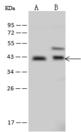 SERPINB6 / PI-6 Antibody - Anti-SERPINB6 rabbit polyclonal antibody at 1:500 dilution. Lane A: A549 Whole Cell Lysate. Lane B: HeLa Whole Cell Lysate. Lysates/proteins at 30 ug per lane. Secondary: Goat Anti-Rabbit IgG (H+L)/HRP at 1/10000 dilution. Developed using the ECL technique. Performed under reducing conditions. Predicted band size: 42 kDa. Observed band size: 42 kDa. (We are unsure as to the identity of these extra bands.)