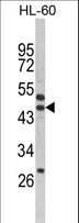 SERPINB7 / MEGSIN Antibody - Western blot of SERPINB7 Antibody in HL-60 cell line lysates (35 ug/lane). SERPINB7 (arrow) was detected using the purified antibody.