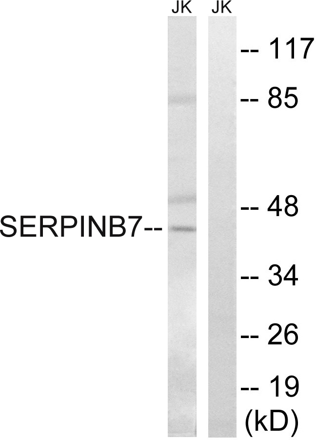 SERPINB7 / MEGSIN Antibody - Western blot analysis of lysates from Jurkat cells, using SERPINB7 Antibody. The lane on the right is blocked with the synthesized peptide.