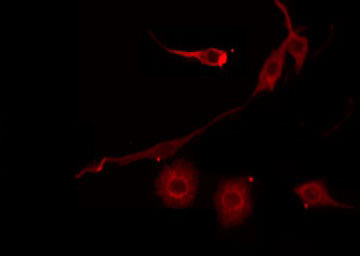 SERPINB7 / MEGSIN Antibody - Staining HeLa cells by IF/ICC. The samples were fixed with PFA and permeabilized in 0.1% Triton X-100, then blocked in 10% serum for 45 min at 25°C. The primary antibody was diluted at 1:200 and incubated with the sample for 1 hour at 37°C. An Alexa Fluor 594 conjugated goat anti-rabbit IgG (H+L) Ab, diluted at 1/600, was used as the secondary antibody.