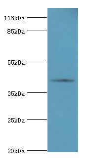 SERPINB8 Antibody - Western blot. All lanes: SERPINB8 Antibody at 2 ug/ml+Jurkat whole cell lysate. Secondary antibody: goat polyclonal to rabbit at 1:10000 dilution. Predicted band size: 43 kDa. Observed band size: 43 kDa.  This image was taken for the unconjugated form of this product. Other forms have not been tested.