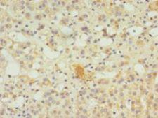 SERPINB8 Antibody - Immunohistochemistry of paraffin-embedded human adrenal gland using antibody at 1:100 dilution.  This image was taken for the unconjugated form of this product. Other forms have not been tested.