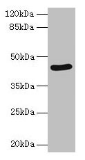 SERPINB8 Antibody - Western blot All lanes: SERPINB8 antibody at 2µg/ml + Jurkat whole cell lysate Secondary Goat polyclonal to rabbit IgG at 1/10000 dilution Predicted band size: 43, 28, 23 kDa Observed band size: 43 kDa