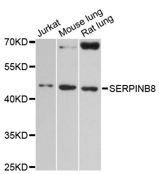 SERPINB8 Antibody - Western blot analysis of extracts of various cell lines, using SERPINB8 antibody at 1:3000 dilution. The secondary antibody used was an HRP Goat Anti-Rabbit IgG (H+L) at 1:10000 dilution. Lysates were loaded 25ug per lane and 3% nonfat dry milk in TBST was used for blocking. An ECL Kit was used for detection and the exposure time was 90s.