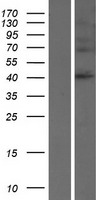 SERPINB8 Protein - Western validation with an anti-DDK antibody * L: Control HEK293 lysate R: Over-expression lysate