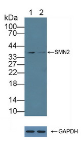 SERPINB9 / PI9 Antibody - Knockout Varification: Lane 1: Wild-type 293T cell lysate; Lane 2: SMN2 knockout 293T cell lysate; Predicted MW: 32,30,29,27kd Observed MW: 37kd Primary Ab: 1µg/ml Rabbit Anti-Human SMN2 Antibody Second Ab: 0.2µg/mL HRP-Linked Caprine Anti-Rabbit IgG Polyclonal Antibody
