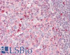 SERPINB9 / PI9 Antibody - Human Tonsil: Formalin-Fixed, Paraffin-Embedded (FFPE)