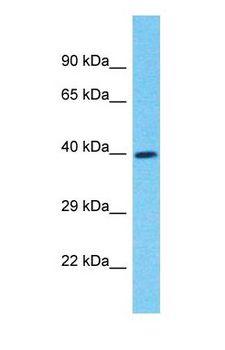 SERPINB9 / PI9 Antibody - Western blot of SERPINB9 Antibody with human Fetal Heart lysate.  This image was taken for the unconjugated form of this product. Other forms have not been tested.