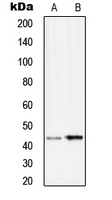 SERPINB9 / PI9 Antibody - Western blot analysis of Serpin B9 expression in Ramos (A); HUVEC (B) whole cell lysates.