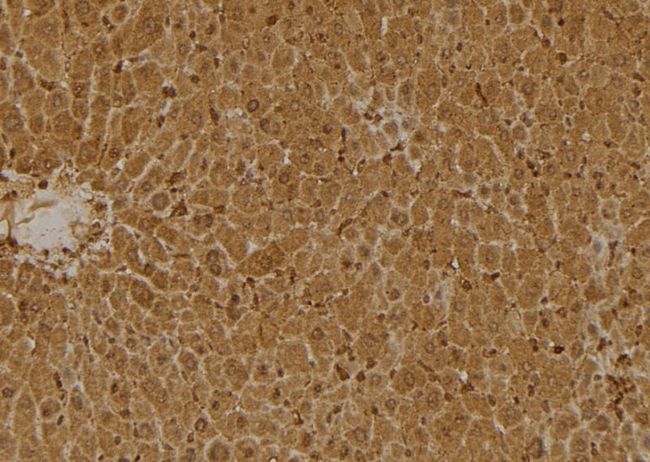 SERPINB9 / PI9 Antibody - 1:100 staining mouse liver tissue by IHC-P. The sample was formaldehyde fixed and a heat mediated antigen retrieval step in citrate buffer was performed. The sample was then blocked and incubated with the antibody for 1.5 hours at 22°C. An HRP conjugated goat anti-rabbit antibody was used as the secondary.