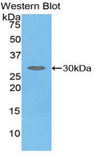 SERPIND1 / Heparin Cofactor 2 Antibody - Western blot of recombinant SERPIND1 / Heparin Cofactor 2.  This image was taken for the unconjugated form of this product. Other forms have not been tested.