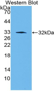 SERPINE1 / PAI-1 Antibody - Western blot of recombinant SERPINE1 / PAI-1.