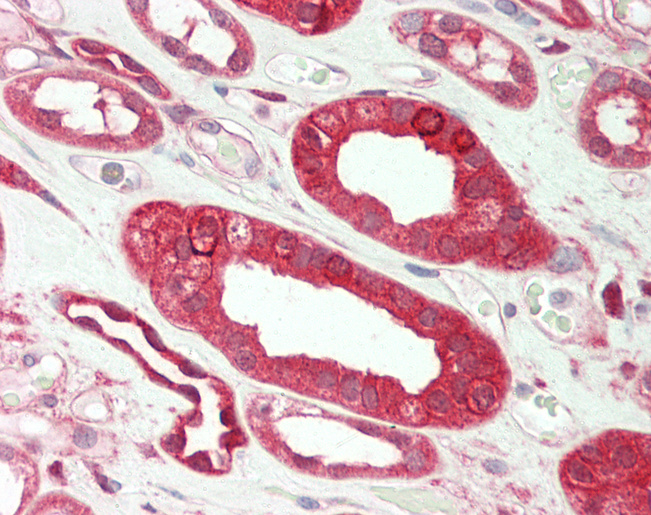 SERPINE1 / PAI-1 Antibody - Human Kidney: Formalin-Fixed, Paraffin-Embedded (FFPE).  This image was taken for the unconjugated form of this product. Other forms have not been tested.