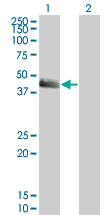 SERPINE1 / PAI-1 Antibody - Western Blot analysis of SERPINE1 expression in transfected 293T cell line by SERPINE1 monoclonal antibody (M01), clone 3F2.Lane 1: SERPINE1 transfected lysate(45.1 KDa).Lane 2: Non-transfected lysate.