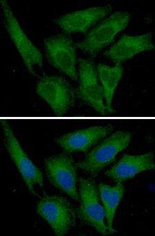 SERPINE1 / PAI-1 Antibody - ICC/IF analysis of PAI1 in HeLa cells line, stained with DAPI (Blue) for nucleus staining and monoclonal anti-human PAI1 antibody (1:100) with goat anti-mouse IgG-Alexa fluor 488 conjugate (Green).