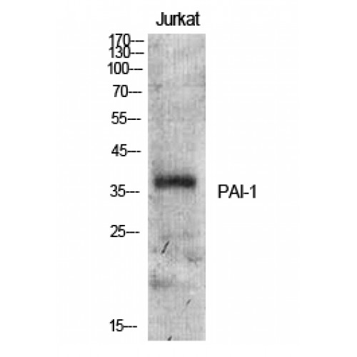 SERPINE1 / PAI-1 Antibody - Western blot of PAI-1 antibody