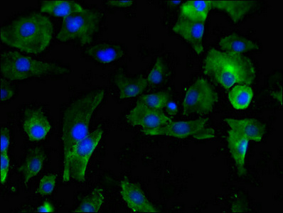 SERPINE1 / PAI-1 Antibody - Immunofluorescent analysis of U251 cells using SERPINE1 Antibody at dilution of 1:100 and Alexa Fluor 488-congugated AffiniPure Goat Anti-Rabbit IgG(H+L)