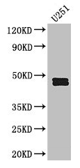 SERPINE1 / PAI-1 Antibody - Western Blot Positive WB detected in: SH-SY5Y whole cell lysate, U251 whole cell lysate All lanes: SERPINE1 antibody at 2.5µg/ml Secondary Goat polyclonal to rabbit IgG at 1/50000 dilution Predicted band size: 46, 44 kDa Observed band size: 46, 44 kDa