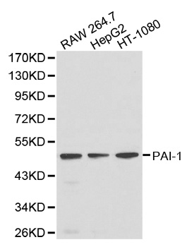 SERPINE1 / PAI-1 Antibody - Western blot analysis of extracts of various cells.