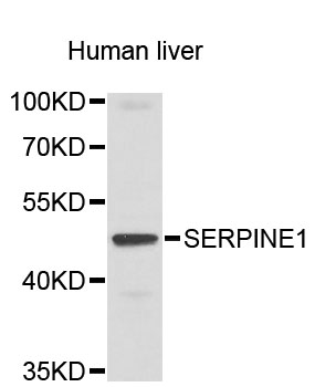 SERPINE1 / PAI-1 Antibody - Western blot analysis of extracts of human liver, using SERPINE1 antibody. The secondary antibody used was an HRP Goat Anti-Rabbit IgG (H+L) at 1:10000 dilution. Lysates were loaded 25ug per lane and 3% nonfat dry milk in TBST was used for blocking.