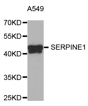 SERPINE1 / PAI-1 Antibody - Western blot analysis of extracts of A549 cells.