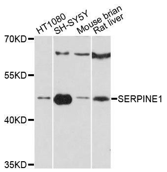 SERPINE1 / PAI-1 Antibody - Western blot analysis of extracts of various cell lines, using SERPINE1 antibody at 1:3000 dilution. The secondary antibody used was an HRP Goat Anti-Rabbit IgG (H+L) at 1:10000 dilution. Lysates were loaded 25ug per lane and 3% nonfat dry milk in TBST was used for blocking. An ECL Kit was used for detection and the exposure time was 40s.