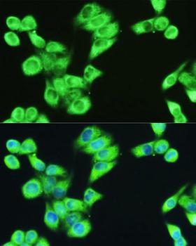SERPINE1 / PAI-1 Antibody - Immunofluorescence analysis of HeLa cells using SERPINE1 antibody at dilution of 1:100. Blue: DAPI for nuclear staining.