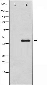 SERPINE1 / PAI-1 Antibody - Western blot analysis of PAI 1 expression in MCF-7 cells. The lane on the left is treated with the antigen-specific peptide.
