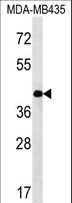 SERPINE2 / Nexin Antibody - SERPINE2 Antibody western blot of MDA-MB435 cell line lysates (35 ug/lane). The SERPINE2 antibody detected the SERPINE2 protein (arrow).