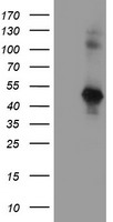 SERPINE2 / Nexin Antibody - HEK293T cells were transfected with the pCMV6-ENTRY control (Left lane) or pCMV6-ENTRY SERPINE2 (Right lane) cDNA for 48 hrs and lysed. Equivalent amounts of cell lysates (5 ug per lane) were separated by SDS-PAGE and immunoblotted with anti-SERPINE2.